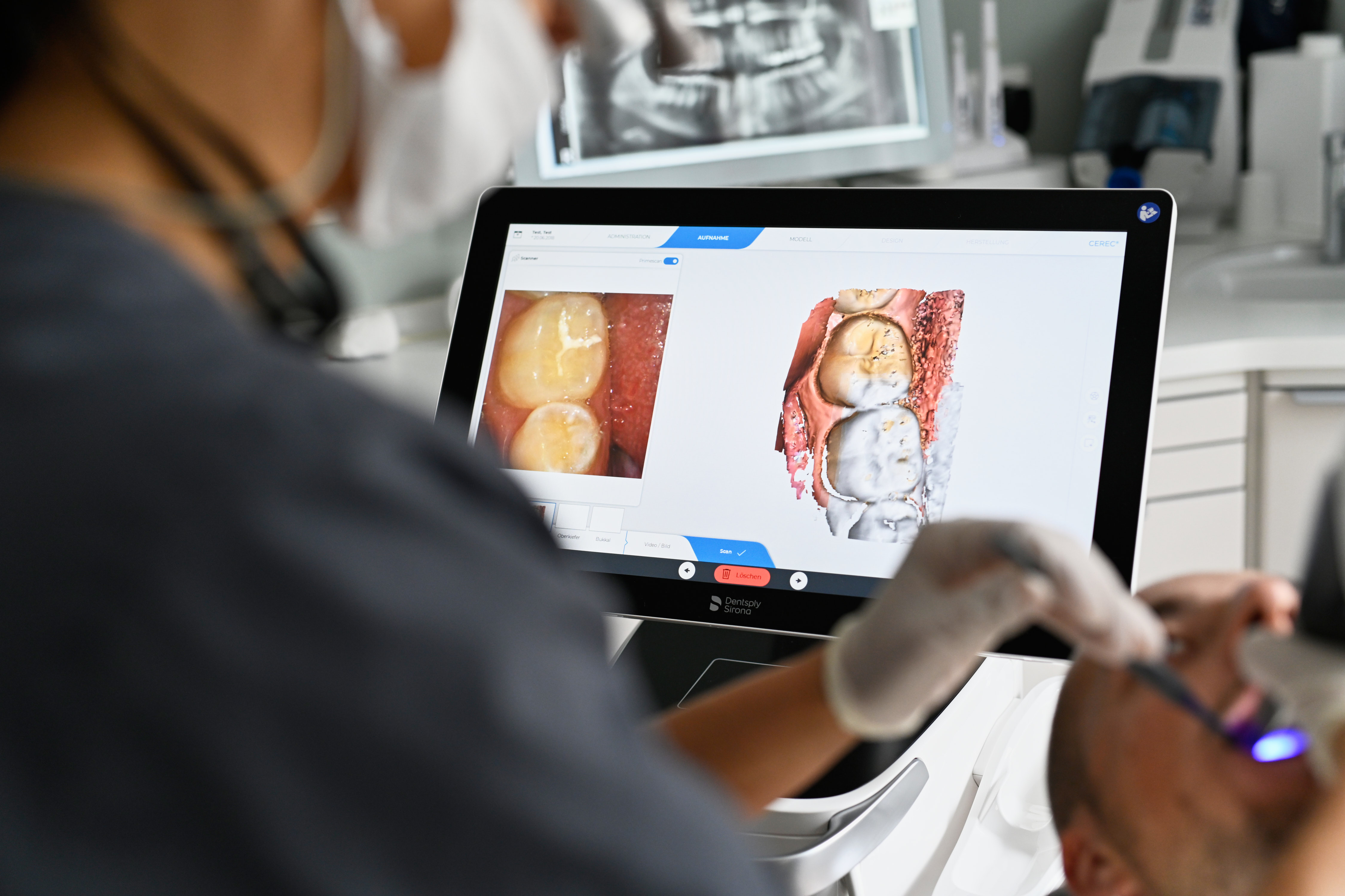 Zahnärztin führt digitalen Abdruck mit CEREC Intraoralscanner durch